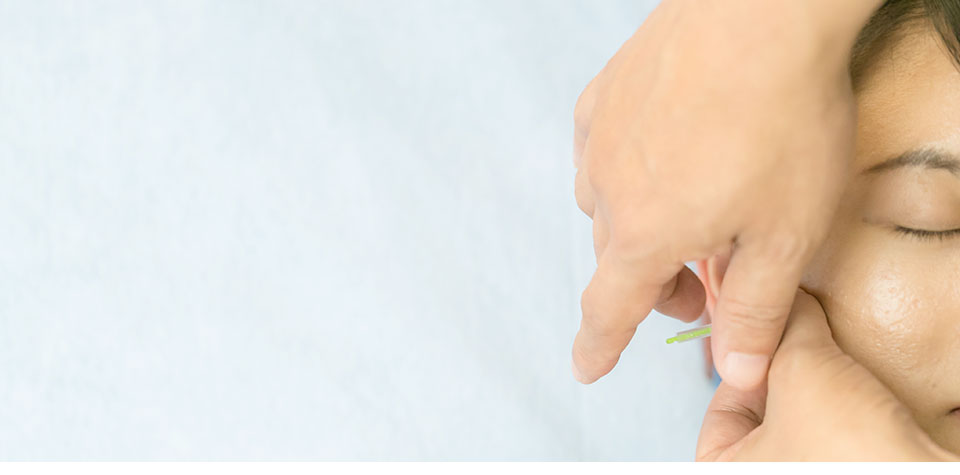 顔面神経麻痺に対する鍼灸治療