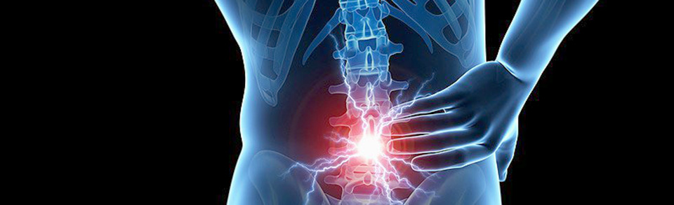 ぎっくり腰の治療