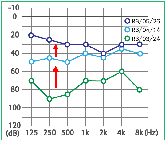 めまい・メニエール病・PPPD