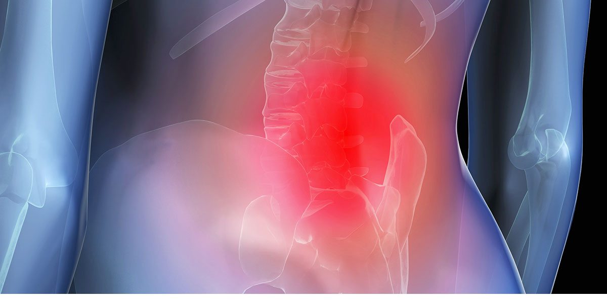 原因不明の腰痛専門外来