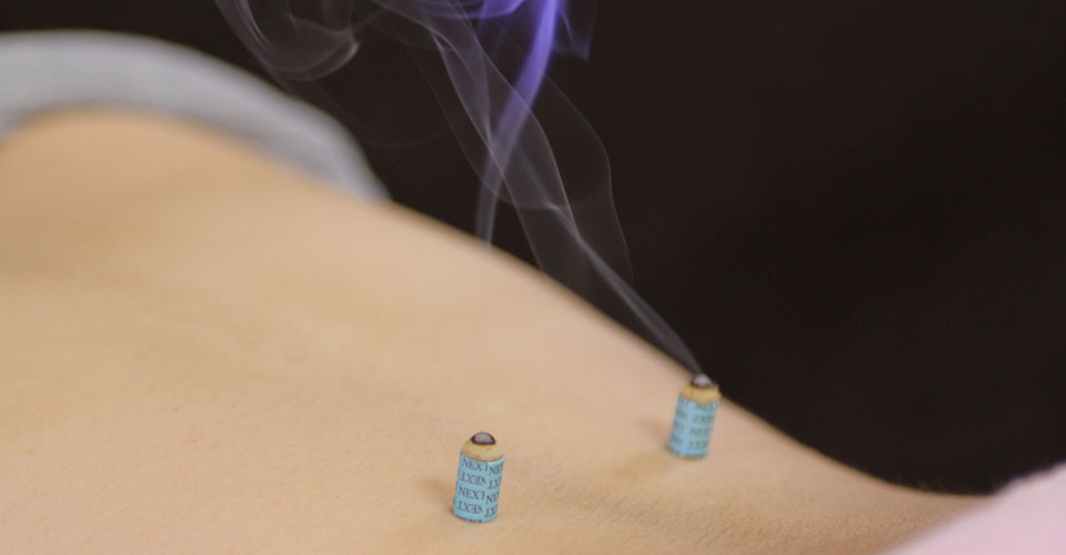 脊柱菅狭窄症の治療